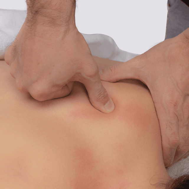 Corso di Massaggio sui Trigger Point